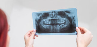 Jak wygląda tomografia komputerowa szczęki i żuchwy