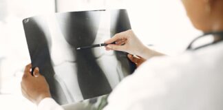 Zdrowe kości to silne fundamenty