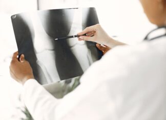 Zdrowe kości to silne fundamenty